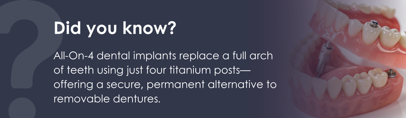 Did you know graphic about All-On-4 dental implants with illustration of implant-supported dentures