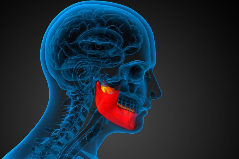 Medical illustration showing the jaw joint highlighted in red, representing TMJ inflammation and pain associated with temporomandibular joint disorder.